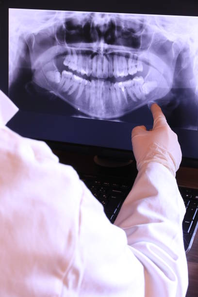 Best Emergency Denture Repair in Buena Vista, VA